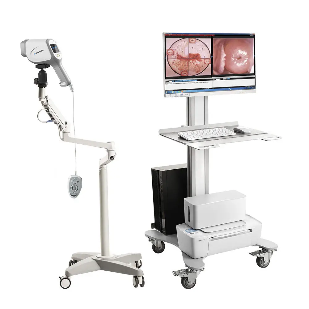 Services imagen colposcope (2)